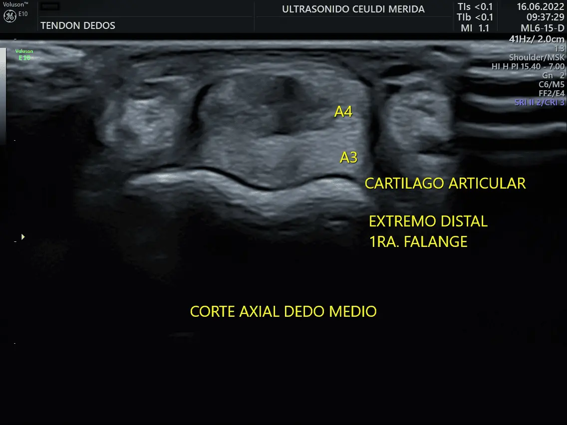 Ultrasonido MSK en Villahermosa